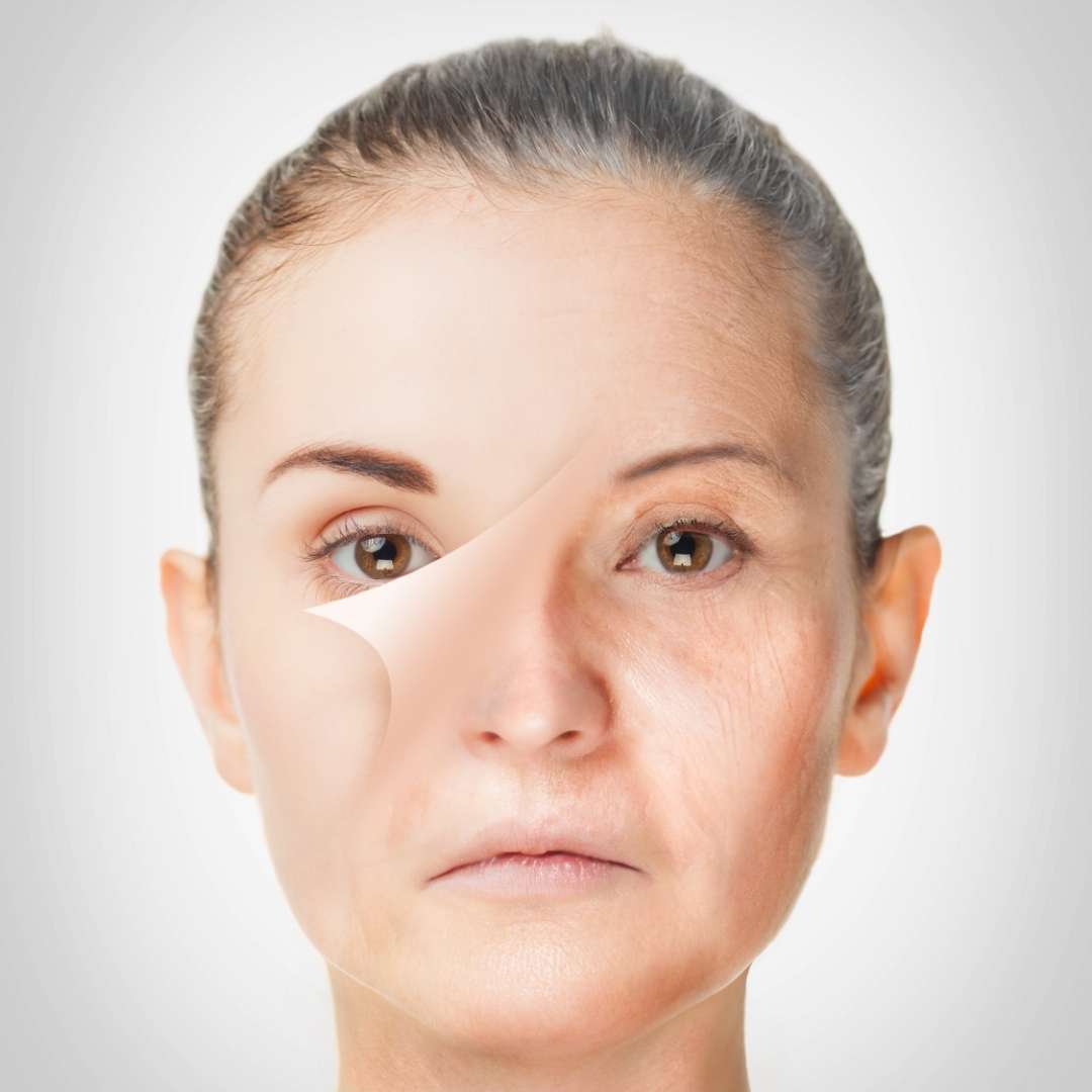 What Products Will Get Rid of Age Spots?